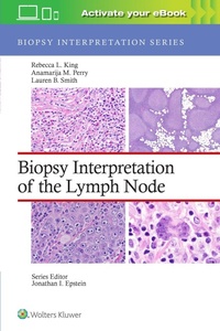Enlarge image Cover: Biopsy Interpretation of the Lymph Node: Print + eBook with Multimedia - WOLTERS KLUWER HEALTH