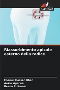 Cover: Riassorbimento apicale esterno della radice - International Book Market Service Ltd