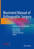 Cover: Illustrated Manual of Orthognathic Surgery - Springer