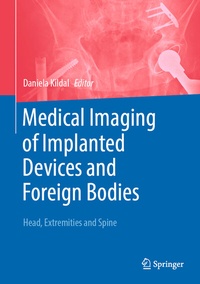 Abbildung von: Medical Imaging of Implanted Devices and Foreign Bodies - Springer
