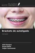 Cover: Brackets de autoligado - Ediciones Nuestro Conocimiento