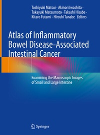 Abbildung von: Atlas of Inflammatory Bowel Disease-Associated Intestinal Cancer - Springer