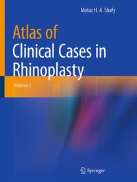 Abbildung von: Atlas of Clinical Cases in Rhinoplasty - Springer