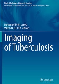 Enlarge image Cover: Imaging of Tuberculosis - Springer