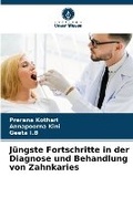 Cover: Juengste Fortschritte in der Diagnose und Behandlung von Zahnkaries - International Book Market Service Ltd