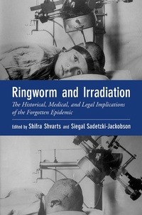 Abbildung von: Ringworm and Irradiation - OUP eBook