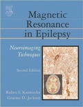 Cover: Magnetic Resonance in Epilepsy - Academic Press