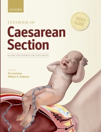 Abbildung von: Textbook of Caesarean Section - OUP Oxford