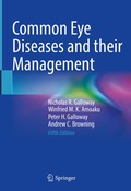 Cover: Common Eye Diseases and their Management - Springer