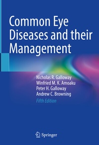 Abbildung von: Common Eye Diseases and their Management - Springer