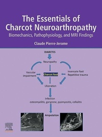 Abbildung von: The Essentials of Charcot Neuroarthropathy - Elsevier