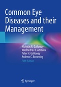 Cover: Common Eye Diseases and their Management - Springer