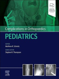 Abbildung von: Complications in Orthopaedics: Pediatrics - E-Book - Elsevier