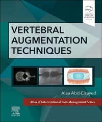 Abbildung von: Vertebral Augmentation Techniques - E-Book - Elsevier