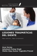 Cover: LESIONES TRAUM&Aacute;TICAS DEL DIENTE - Ediciones Nuestro Conocimiento