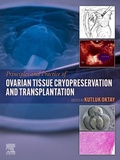 Bild: Principles and Practice of Ovarian Tissue Cryopreservation and Transplantation - Elsevier
