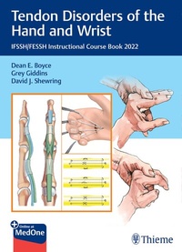 Abbildung von: Tendon Disorders of the Hand and Wrist - Thieme