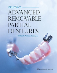 Abbildung von: Brudvik's Advanced Removable Partial Dentures - Quintessence Publishing Co, Inc