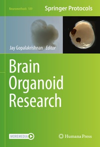 Abbildung von: Brain Organoid Research - Humana