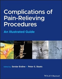 Abbildung von: Complications of Pain-Relieving Procedures - Wiley