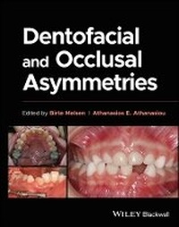 Enlarge image Cover: Dentofacial and Occlusal Asymmetries - Wiley