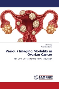 Enlarge image Cover: Various Imaging Modality in Ovarian Cancer - LAP Lambert Academic Publishing
