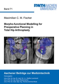 Abbildung von: Morpho-functional Modelling for Preoperative Planning in Total Hip Arthroplasty - Shaker