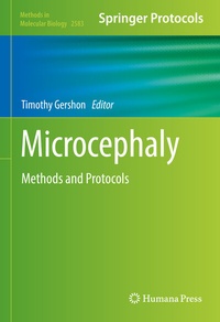 Abbildung von: Microcephaly - Humana