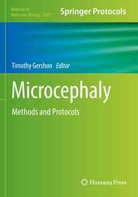 Abbildung von: Microcephaly - Springer