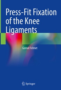 Abbildung von: Press-Fit Fixation of the Knee Ligaments - Springer