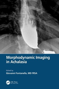 Abbildung von: Morphodynamic Imaging in Achalasia - CRC Press
