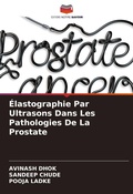 Cover: &Eacute;lastographie Par Ultrasons Dans Les Pathologies De La Prostate - Editions Notre Savoir