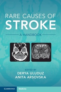 Abbildung von: Rare Causes of Stroke - Cambridge University Press