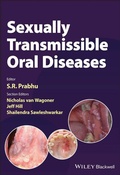 Abbildung von: Sexually Transmissible Oral Diseases - Wiley