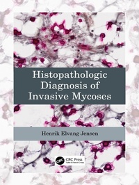 Abbildung von: Histopathologic Diagnosis of Invasive Mycoses - CRC Press