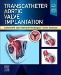 Bild: Transcatheter Aortic Valve Implantation - Elsevier