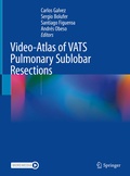 Bild: Video-Atlas of VATS Pulmonary Sublobar Resections - Springer