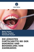 Cover: DIE J&Uuml;NGSTEN FORTSCHRITTE BEI DER DIAGNOSE UND BEHANDLUNG VON ZAHNKARIES - Verlag Unser Wissen
