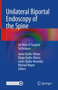 Abbildung von: Unilateral Biportal Endoscopy of the Spine - Springer