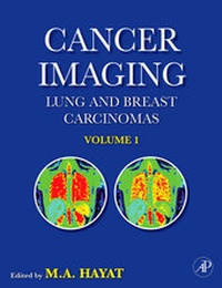 Abbildung von: Cancer Imaging - Academic Press