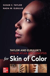 Abbildung von: Taylor and Elbuluk's Color Atlas and Synopsis for Skin of Color - McGraw Hill LLC