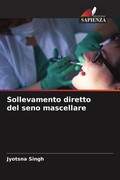 Cover: Sollevamento diretto del seno mascellare - Edizioni Sapienza