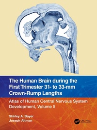 Abbildung von: The Human Brain during the First Trimester 31- to 33-mm Crown-Rump Lengths - CRC Press