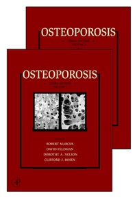 Abbildung von: Osteoporosis - Academic Press