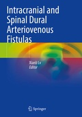Cover: Intracranial and Spinal Dural Arteriovenous Fistulas - Springer