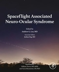 Abbildung von: Spaceflight Associated Neuro-Ocular Syndrome - Academic Press