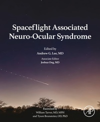 Abbildung von: Spaceflight Associated Neuro-Ocular Syndrome - Academic Press