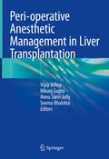 Cover: Peri-operative Anesthetic Management in Liver Transplantation - Springer