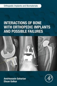 Abbildung von: Interactions of Bone with Orthopedic Implants and Possible Failures - Academic Press