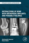 Bild: Interactions of Bone with Orthopedic Implants and Possible Failures - Academic Press
